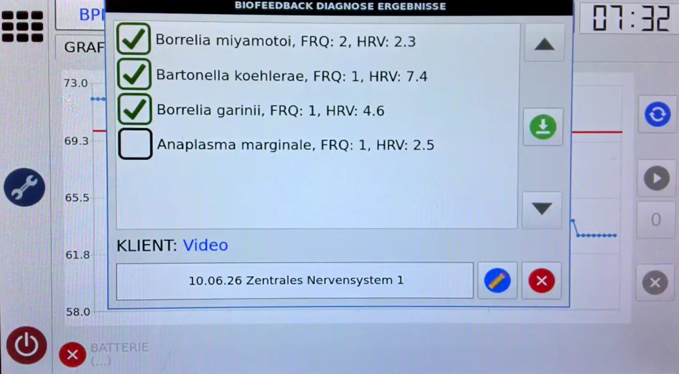Gespeicherte Ergebnisanzeige eines Bio-Feedback-Scans im RIFETECH Plasma Gerät