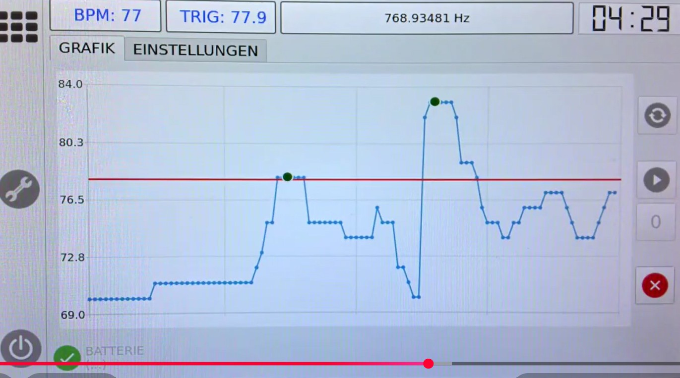 HRV-Verlauf während einer Bio-Feedback-Analyse mit dem RIFETECH Plasma Gerät