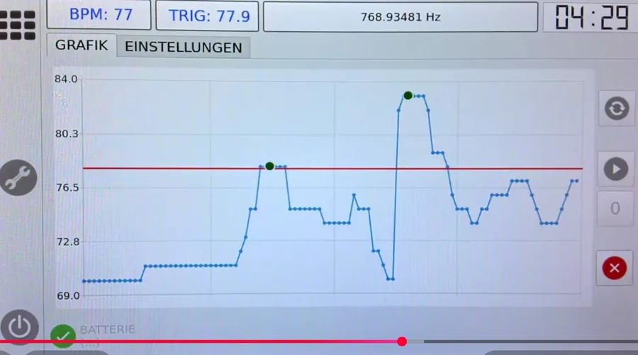 Grafische Darstellung des HRV-Verlaufs während eines Bio-Feedback-Scans